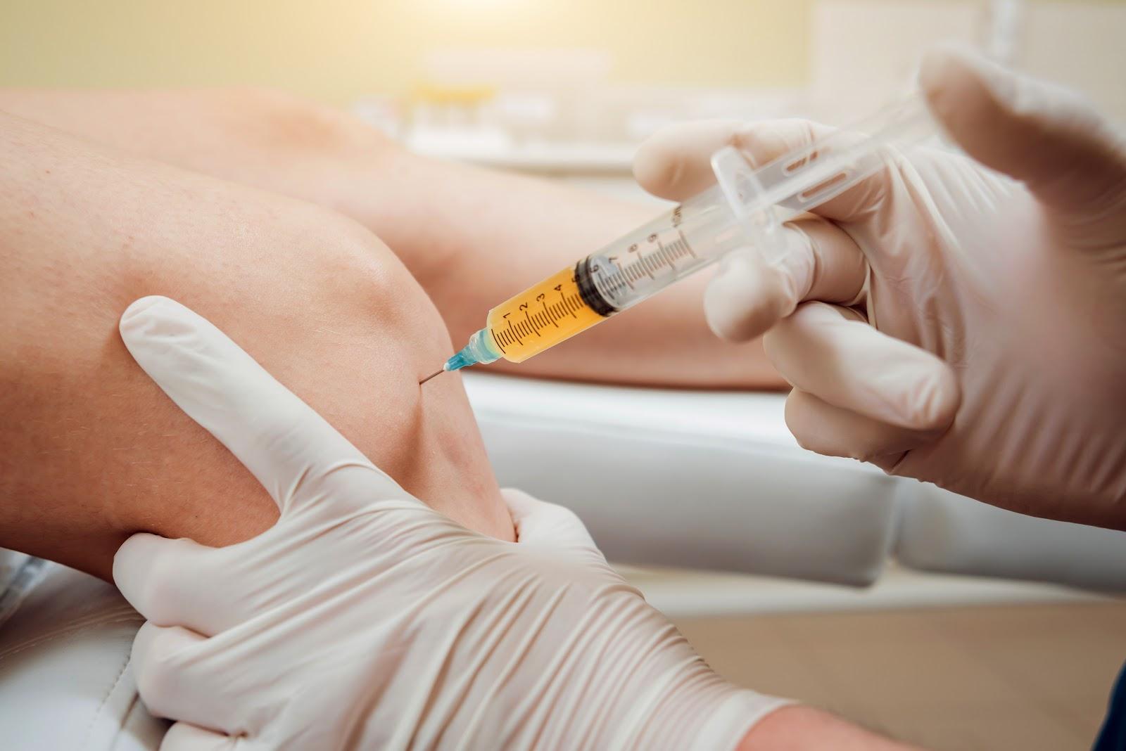 Arzt bereitet ACP-Eigenbluttherapie für die Injektion ins Kniegelenk vor