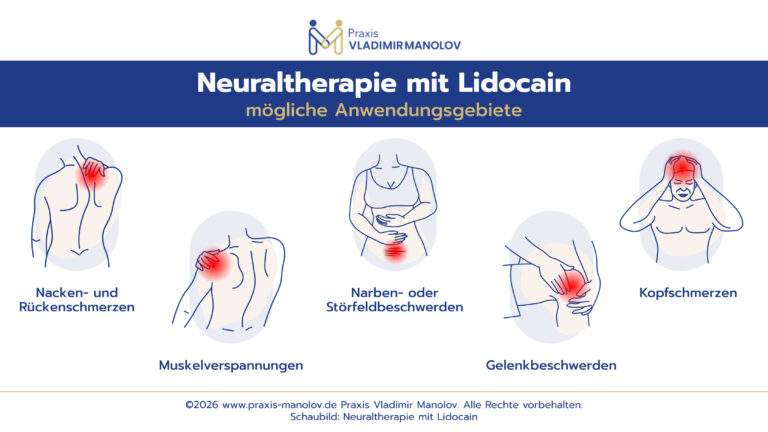 Infografik zu Beschwerdebildern, bei denen Neuraltherapie mit Lidocain eingesetzt beziehungsweise diskutiert wird